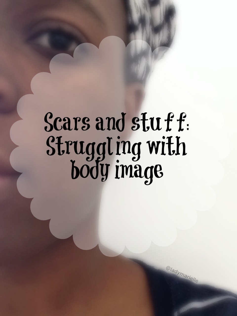 Scars and stuff. Struggling with body image